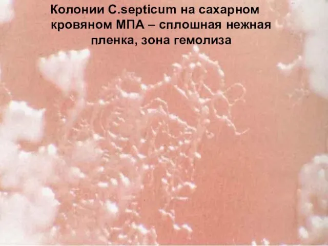 Колонии C.septiсum на сахарном кровяном МПА – сплошная нежная пленка, зона гемолиза