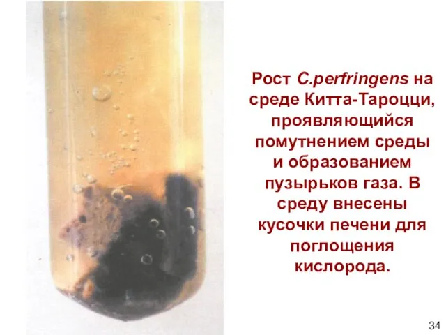 Рост C.perfringens на среде Китта-Тароцци, проявляющийся помутнением среды и образованием