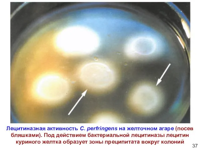 Лецитиназная активность C. perfringens на желточном агаре (посев бляшками). Под