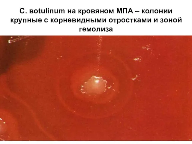 C. вotulinum на кровяном МПА – колонии крупные с корневидными отростками и зоной гемолиза