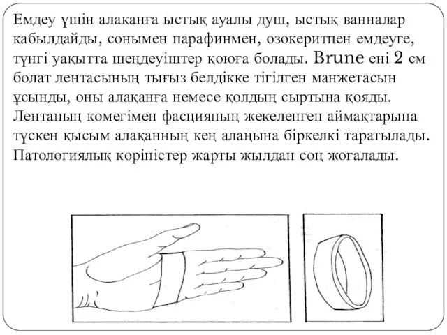 Емдеу үшін алақанға ыстық ауалы душ, ыстық ванналар қабылдайды, сонымен