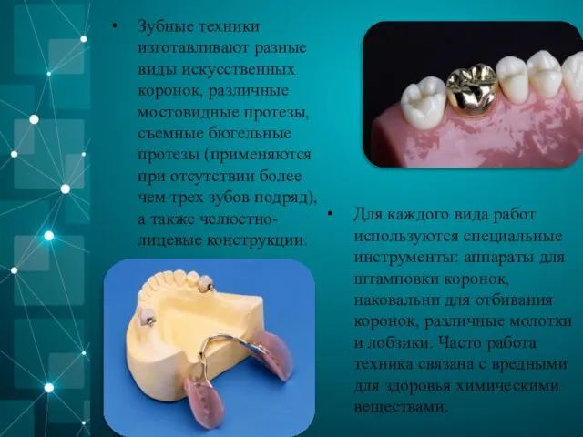 Зубные техники изготавливают разные виды искусственных коронок, различные мостовидные протезы,