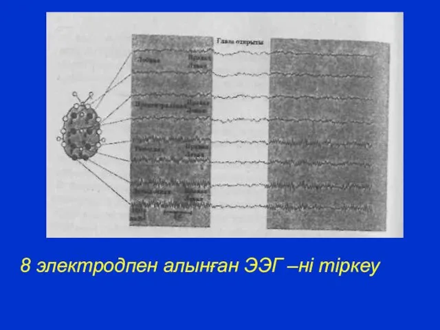 8 электродпен алынған ЭЭГ –ні тіркеу