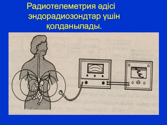 Радиотелеметрия әдісі эндорадиозондтар үшін қолданылады.