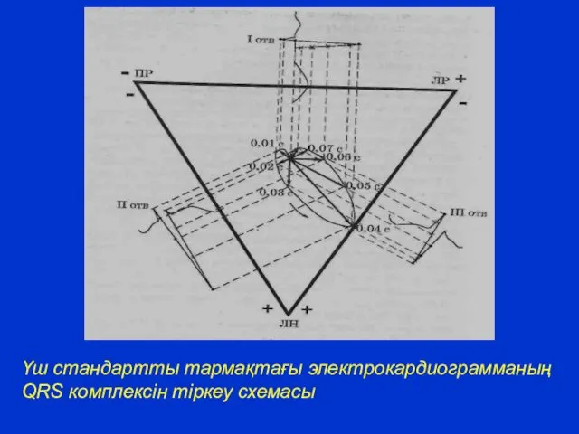 Үш стандартты тармақтағы электрокардиограмманың QRS комплексін тіркеу схемасы