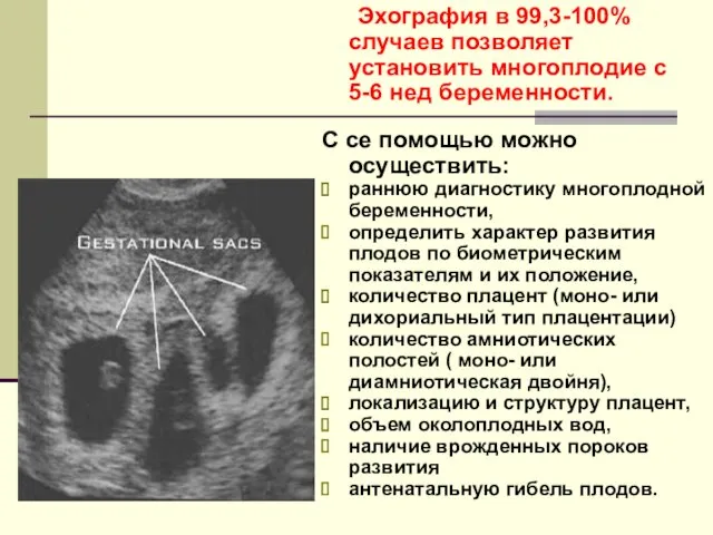 Эхография в 99,3-100% случаев позволяет установить многоплодие с 5-6 нед