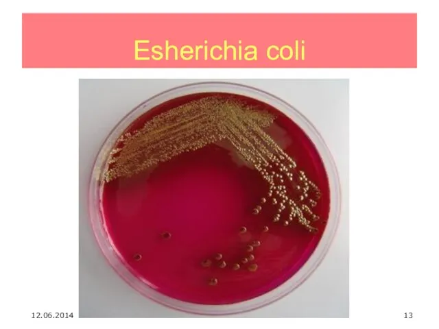 Esherichia coli 12.06.2014