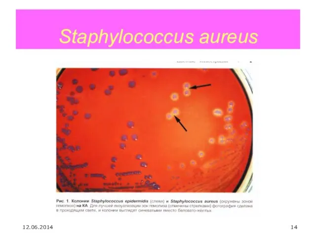 Staphylococcus aureus 12.06.2014