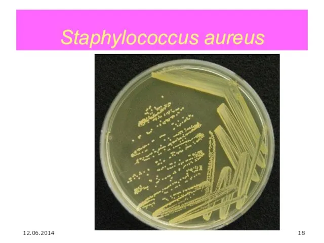 Staphylococcus aureus 12.06.2014