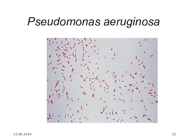 Pseudomonas aeruginosa 12.06.2014