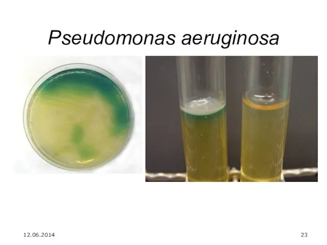 Pseudomonas aeruginosa 12.06.2014