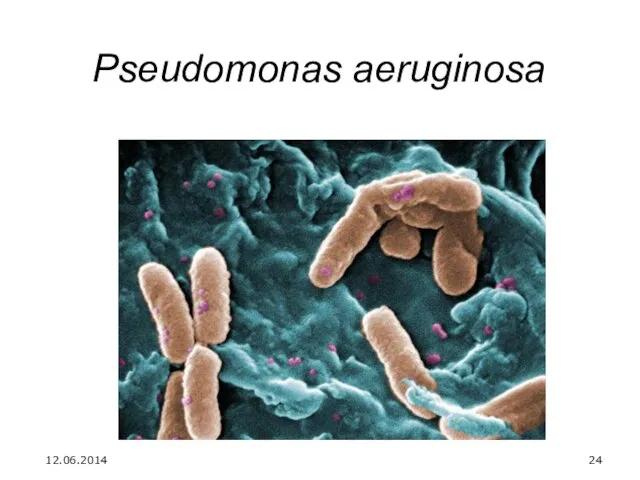 Pseudomonas aeruginosa 12.06.2014