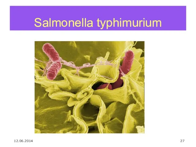 Salmonella typhimurium 12.06.2014