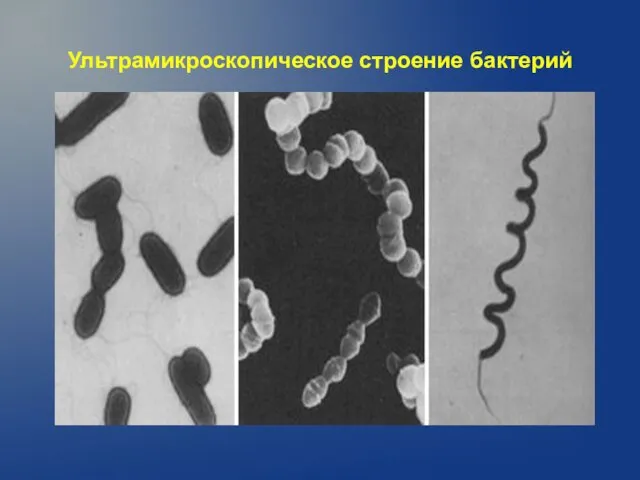 Ультрамикроскопическое строение бактерий