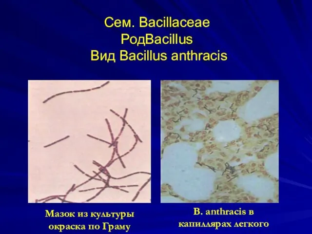 Сем. Bacillaceae РодBacillus Вид Bacillus anthracis Мазок из культуры окраска