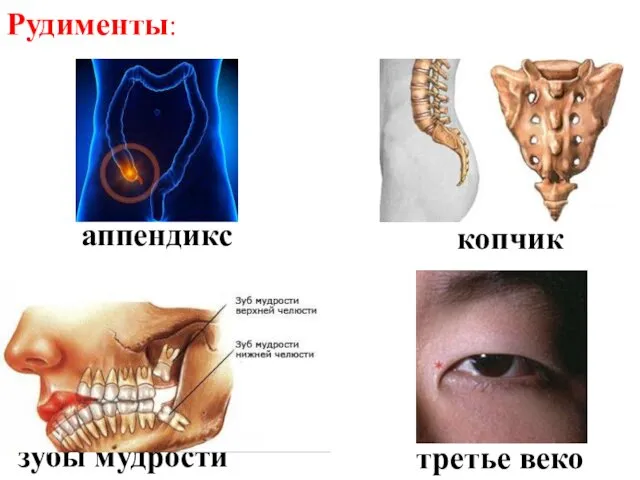 Рудименты: аппендикс копчик третье веко зубы мудрости