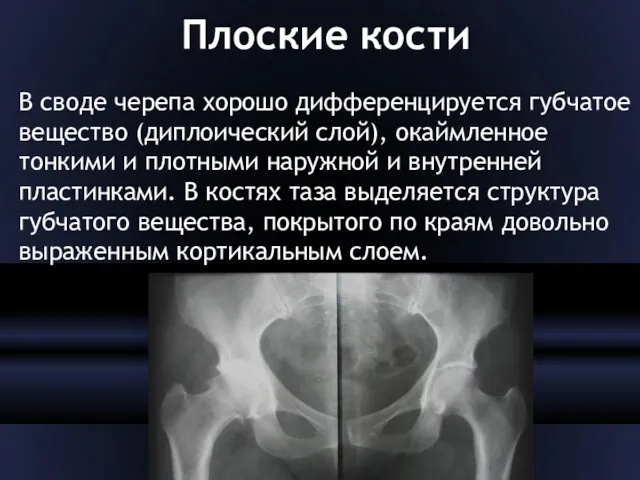 Плоские кости В своде черепа хорошо дифференцируется губчатое вещество (диплоический слой), окаймленное тонкими
