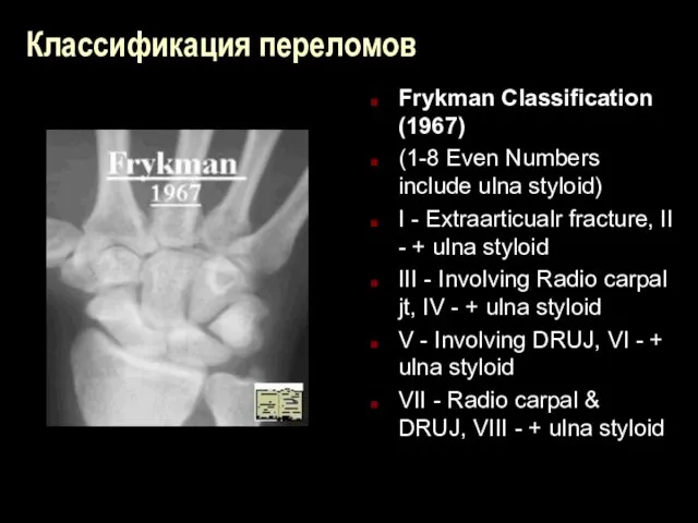 Классификация переломов Frykman Classification (1967) (1-8 Even Numbers include ulna