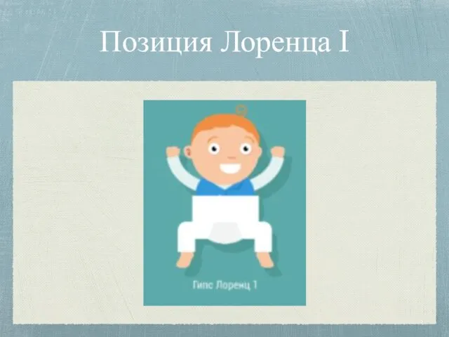 Позиция Лоренца I