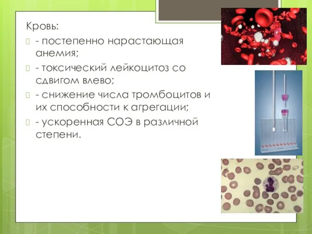 Кровь: - постепенно нарастающая анемия; - токсический лейкоцитоз со сдвигом