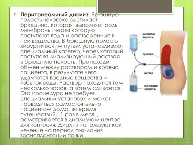 Перитонеальный диализ. Брюшную полость человека выстилает брюшина, которая выполняет роль