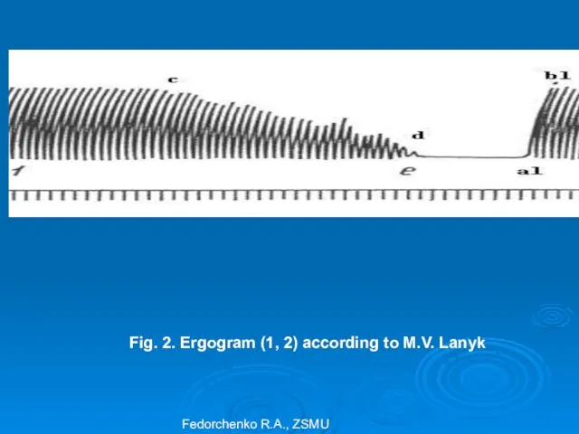 Fig. 2. Ergogram (1, 2) according to M.V. Lanyk Fedorchenko R.A., ZSMU