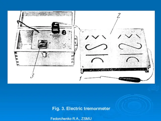 Fig. 3. Electric tremormeter Fedorchenko R.A., ZSMU