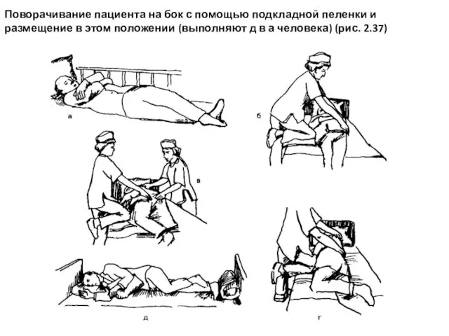 Поворачивание пациента на бок с помощью подкладной пеленки и размещение в этом положении