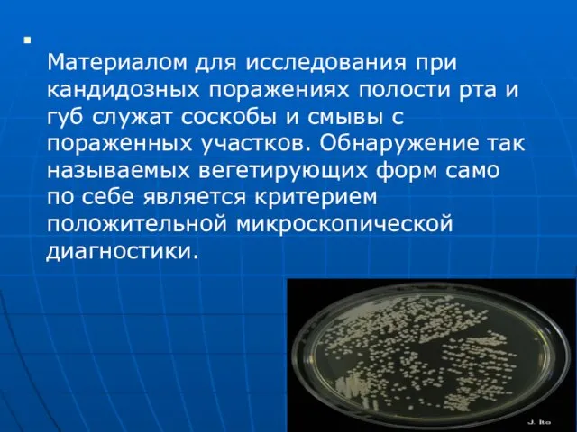 Материалом для исследования при кандидозных поражениях полости рта и губ