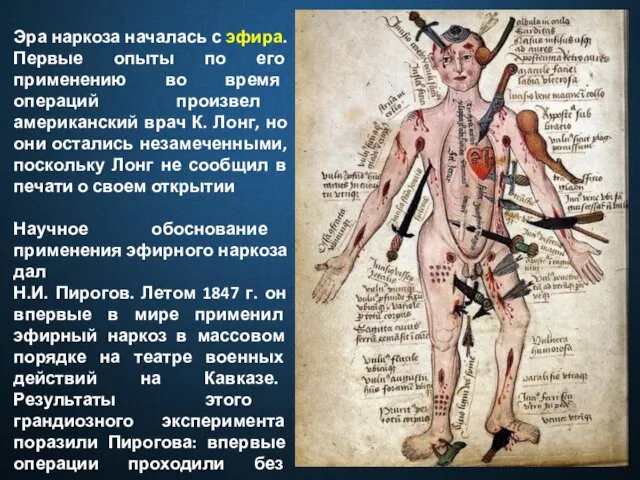 Эра наркоза началась с эфира. Первые опыты по его применению