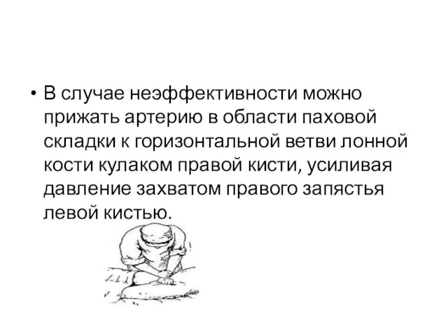 В случае неэффективности можно прижать артерию в области паховой складки