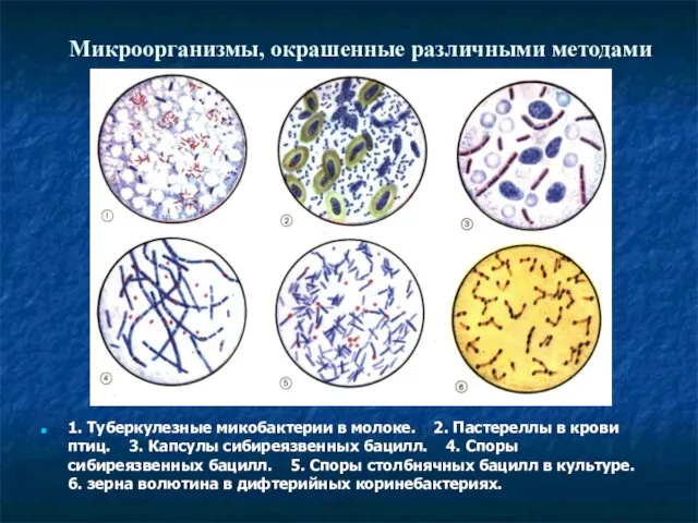 Микроорганизмы, окрашенные различными методами 1. Туберкулезные микобактерии в молоке. 2.