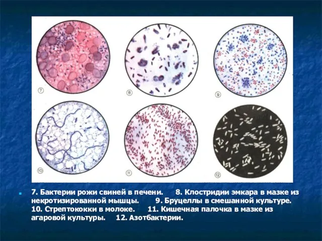 7. Бактерии рожи свиней в печени. 8. Клостридии эмкара в