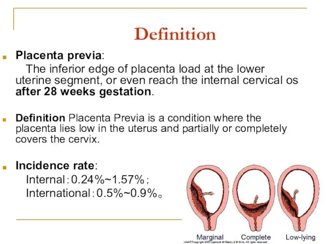 Definition Placenta previa: The inferior edge of placenta load at