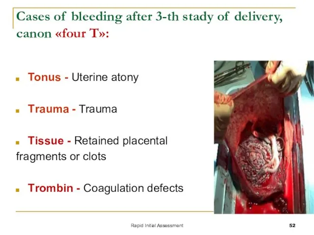 Rapid Initial Assessment Cases of bleeding after 3-th stady of