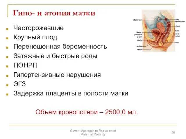 Гипо- и атония матки Часторожавшие Крупный плод Переношенная беременность Затяжные