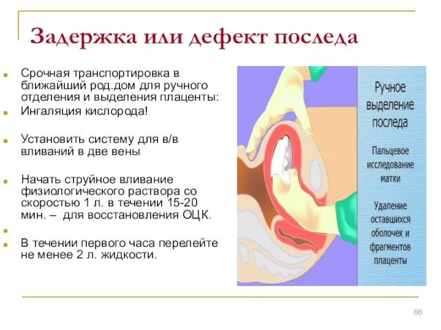 Задержка или дефект последа Срочная транспортировка в ближайший род.дом для