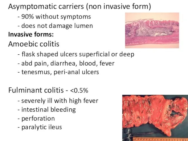 Asymptomatic carriers (non invasive form) - 90% without symptoms -