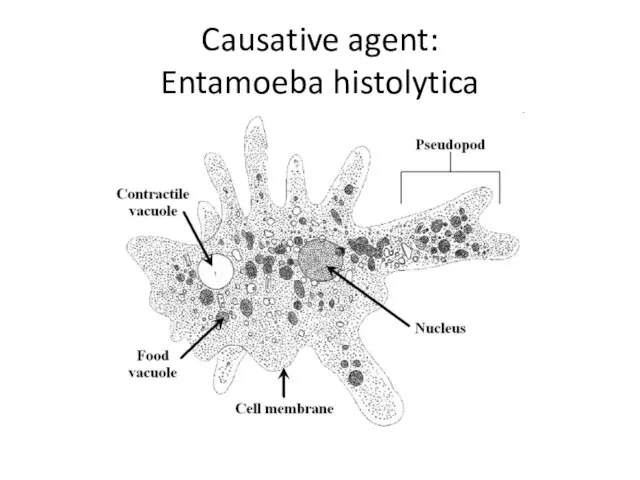 Causative agent: Entamoeba histolytica