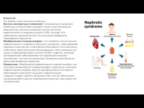 Этиология Эти формы самые распространенные: Болезнь минимальных изменений : минимальные