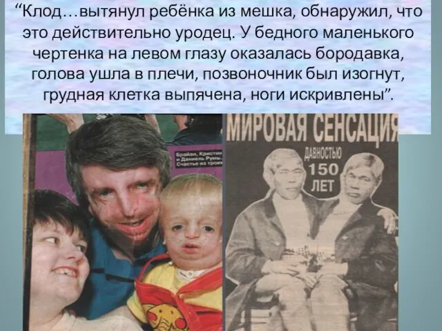 “Клод…вытянул ребёнка из мешка, обнаружил, что это действительно уродец. У