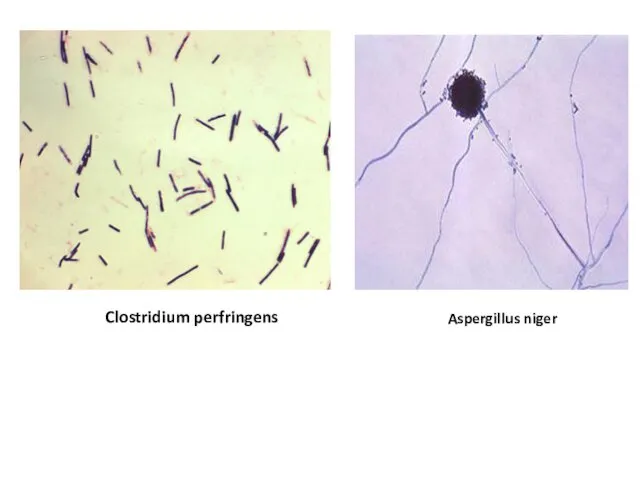 Clostridium perfringens Aspergillus niger