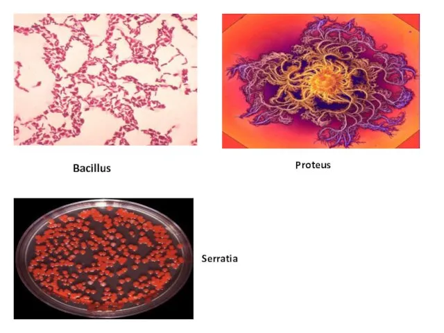 Bacillus Proteus Serratia