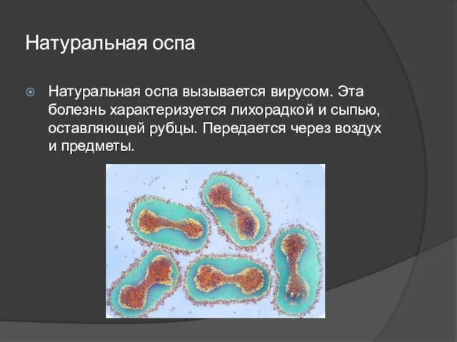 Натуральная оспа Натуральная оспа вызывается вирусом. Эта болезнь характеризуется лихорадкой