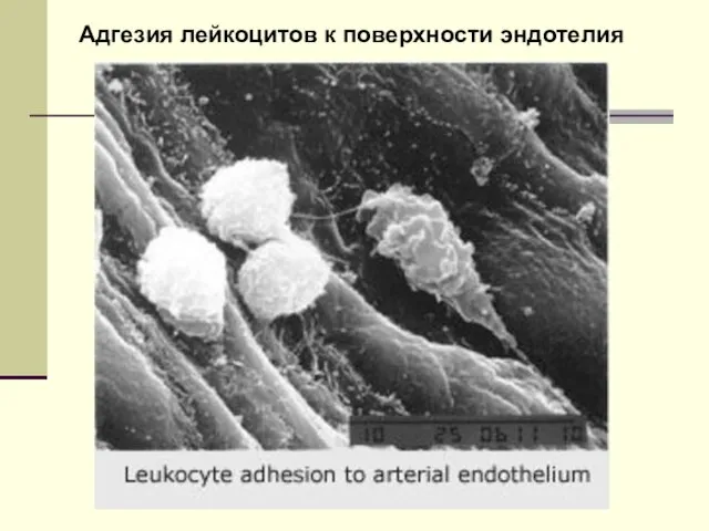 Адгезия лейкоцитов к поверхности эндотелия
