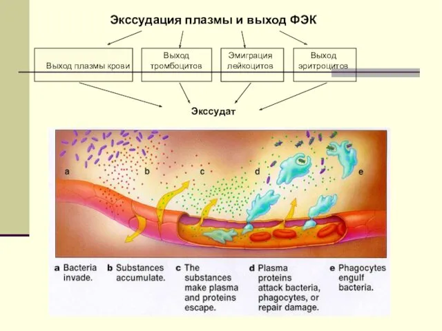 Экссудация плазмы и выход ФЭК Выход плазмы крови Выход тромбоцитов Эмиграция лейкоцитов Выход эритроцитов Экссудат