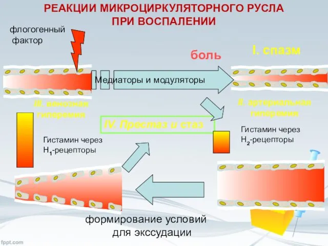 РЕАКЦИИ МИКРОЦИРКУЛЯТОРНОГО РУСЛА ПРИ ВОСПАЛЕНИИ флогогенный фактор боль Медиаторы и