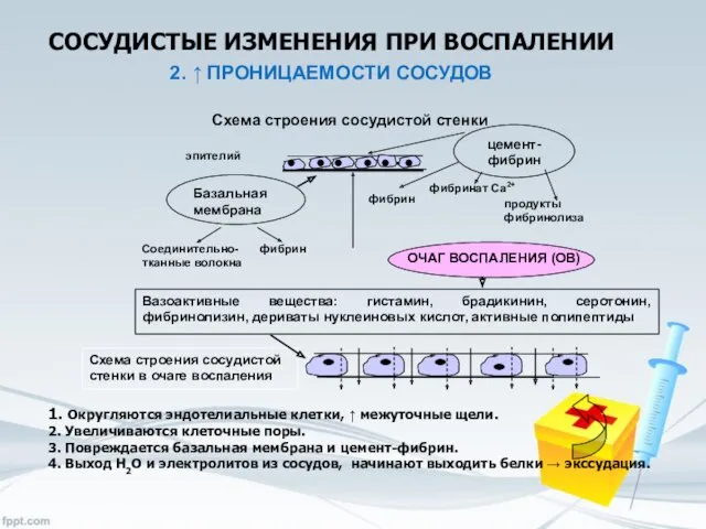 СОСУДИСТЫЕ ИЗМЕНЕНИЯ ПРИ ВОСПАЛЕНИИ 2. ↑ ПРОНИЦАЕМОСТИ СОСУДОВ