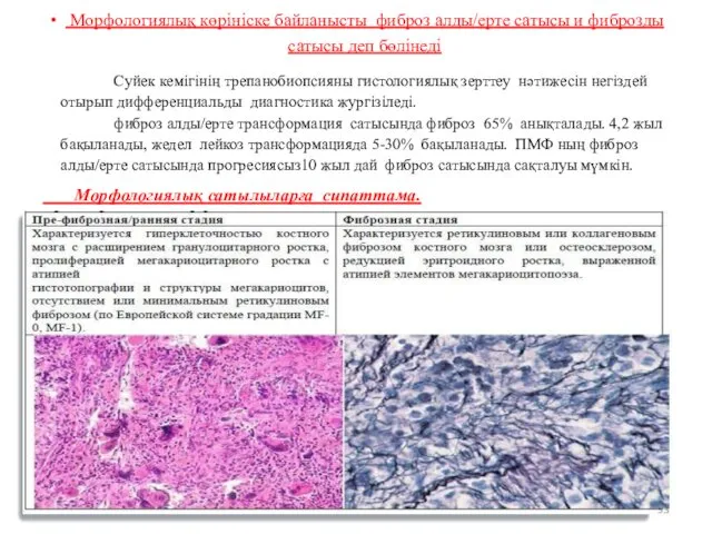 Морфологиялық көрініске байланысты фиброз алды/ерте сатысы и фиброзды сатысы деп бөлінеді Суйек кемігінің