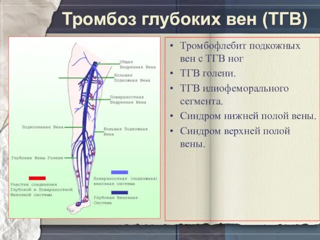 Тромбоз глубоких вен (ТГВ) Тромбофлебит подкожных вен с ТГВ ног ТГВ голени. ТГВ